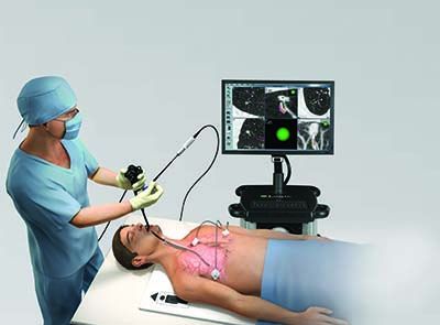 Бронхоскопия