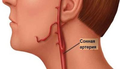 Расположение сонной артерии на шее: фото и информация