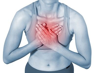 Шейно-грудной радикулит: симптомы, лечение