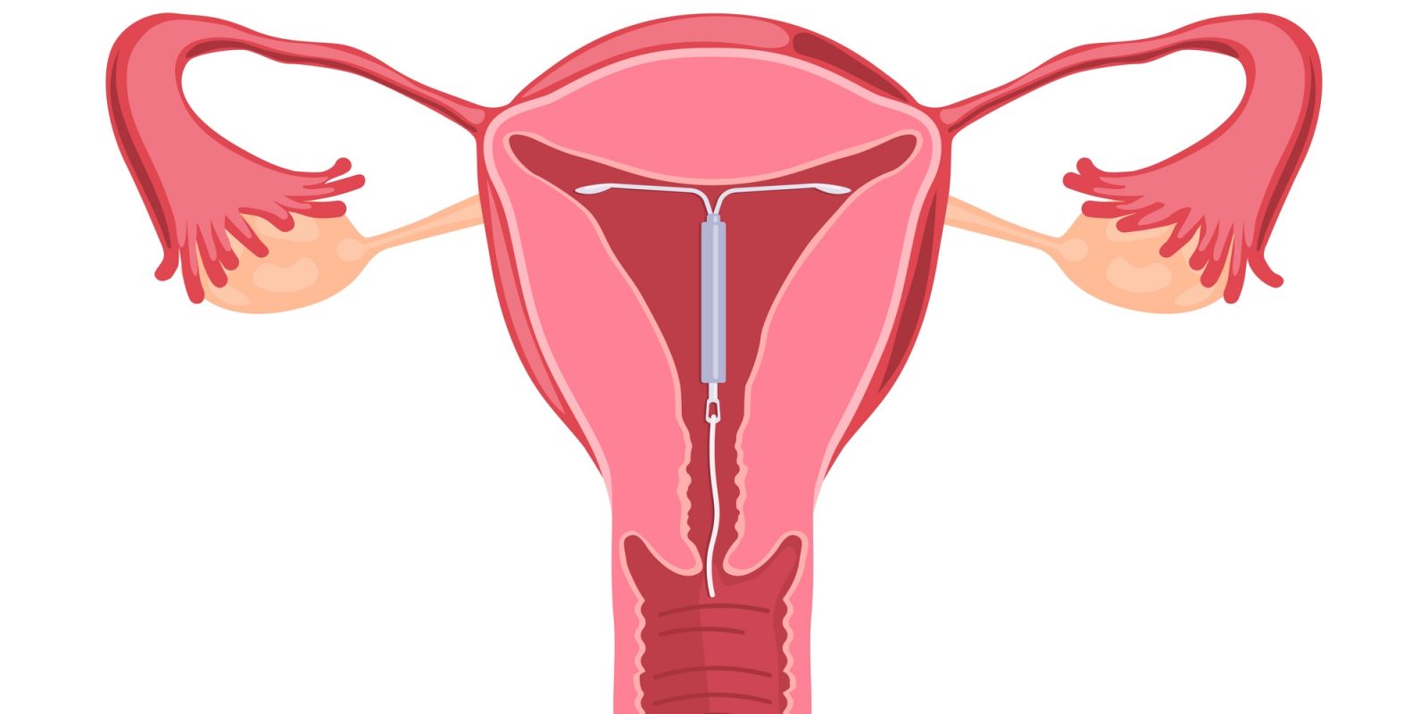 Врач-гинеколог объяснила почему нельзя терпеть боль внизу живота во время менструации