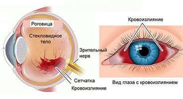 Красные глаза: лечение и профилактика