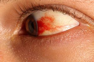 Травмы глаз у детей