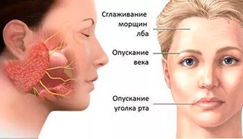 Ассиметрия лица - симптомы, диагностика, методы лечения.