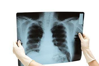 Рентген органов брюшной полости (обзорный) — Клиника «Доктор рядом»