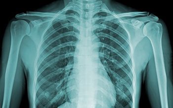 МРТ при туберкулезе позвоночника - что покажет