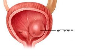 Хирургия женской уретры