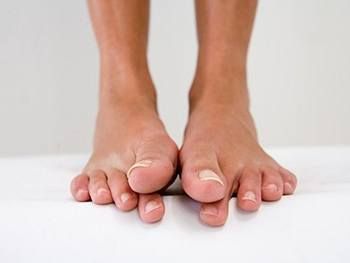 Онемение ног