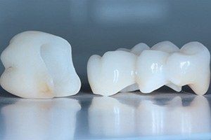 Коронка керамическая «E-MAX» в клинике ЦЭЛТ в Москве