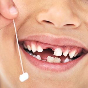 Удаление молочных и коренных зубов у детей в клинике ЦЭЛТ в Москве