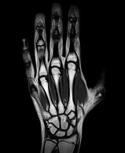 Магнитно-резонансная томография кисти и лучезапястного сустава одной руки в клинике ЦЭЛТ в Москве