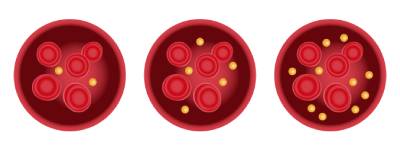 Эозинофилия