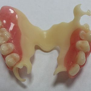 Протезирование съемными бюгельными протезами «Кватротти» в клинике ЦЭЛТ в Москве