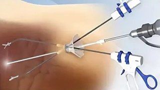 Эндоскопи в клинике ЦЭЛТ в Москве