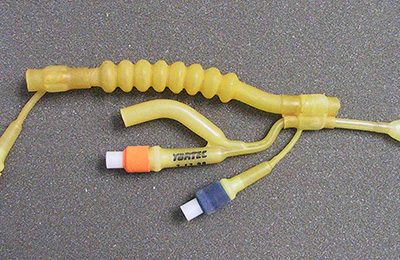 Промывание околоносовых пазух и носоглотки в клинике ЦЭЛТ в Москве