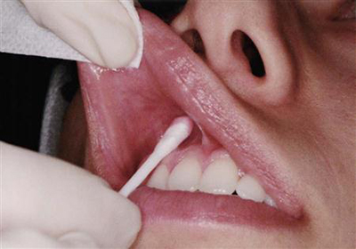 Аппликационная анестезия в клинике ЦЭЛТ в Москве