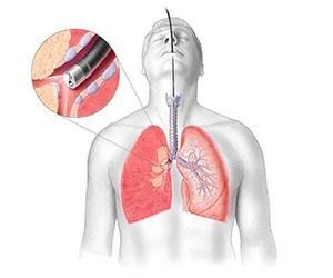Бронхоскопия легких в клинике ЦЭЛТ в Москве