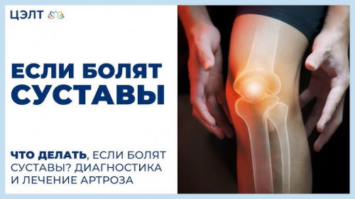 Если болят суставы. Что делать, если болят суставы Диагностика и лечение артроза. ЦЭЛТ