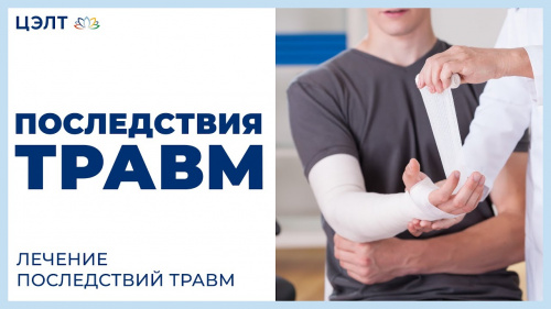 Последствия травм. Лечение последствий травм. ЦЭЛТ.