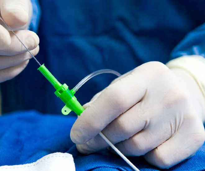 Коронарография одного дня всего за 35000₽!